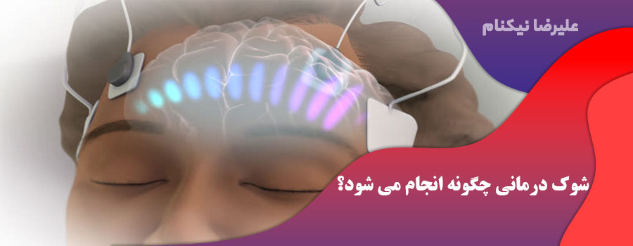 شوک درمانی چگونه انجام می شود؟