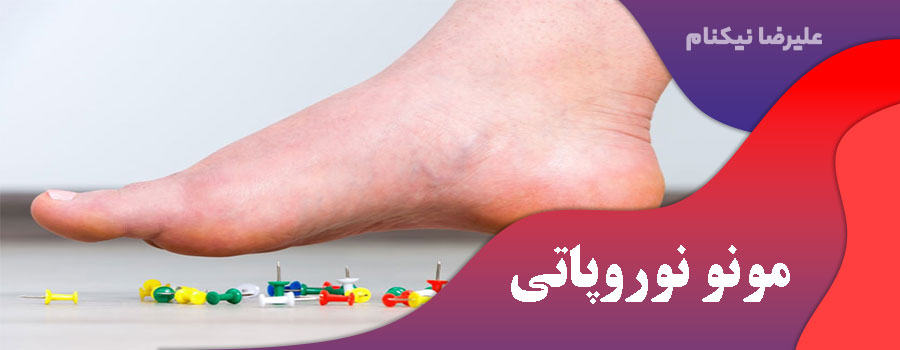 مونو نوروپاتی