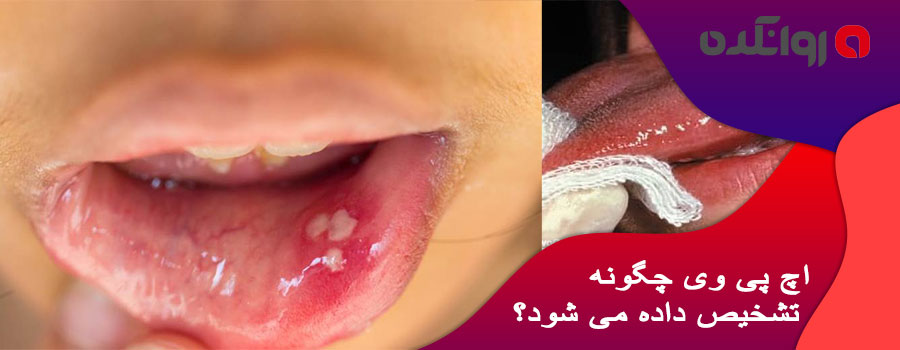 اچ-پی-وی-چگونه-تشخیص-داده-می-شود؟