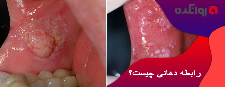 رابطه-دهانی-چیست؟