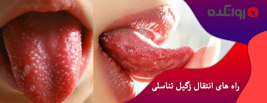 راه-های-انتقال-زگیل-تناسلی